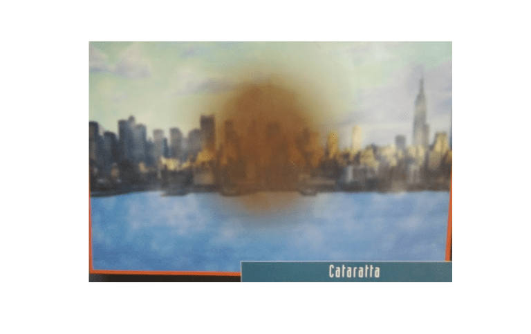 CATARATTA